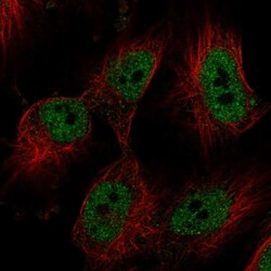 FBRS Antibody, Novus Biologicals 25 &mu;L; Unlabeled:Antibodies, Polyclonal